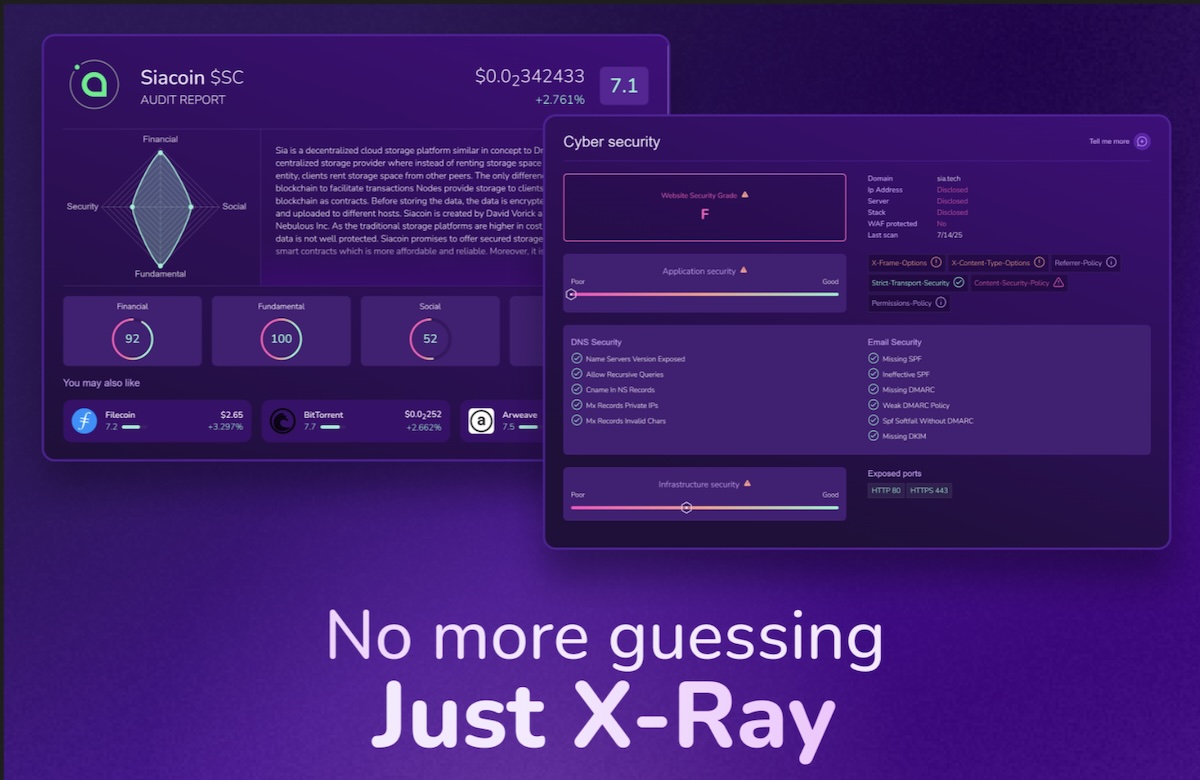 X-Ray interface
